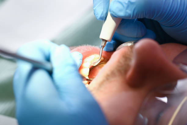 Best Emergency Orthodontic Repairs in Georgetown, CA
