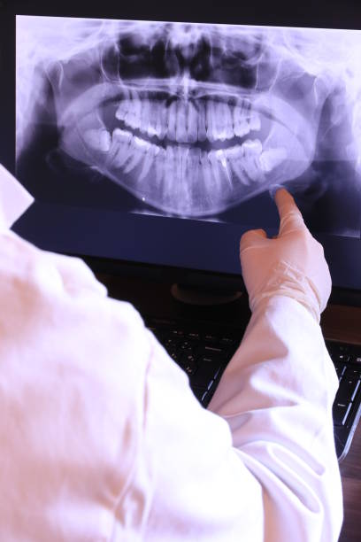 Best Emergency Treatment for Toothache in Georgetown, CA