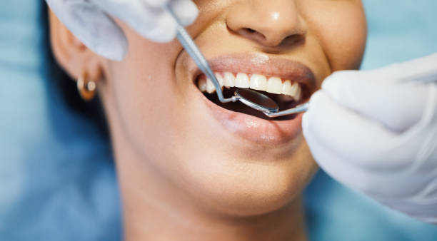 Best Emergency Wisdom Teeth Removal in Georgetown, CA