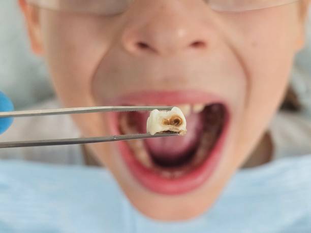 Best Same-Day Emergency Dentist in Georgetown, CA