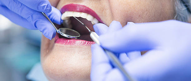 Best Emergency Broken Tooth Repair in Georgetown, CA